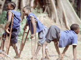 Medical Practitioner wants Nigeria to be Polio-Free