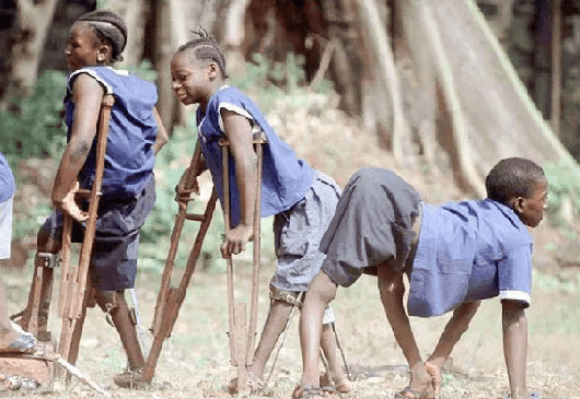 Medical Practitioner wants Nigeria to be Polio-Free