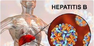 World Hepatitis Day: Over 18m Nigerians Infected with Hepatitis – Minister