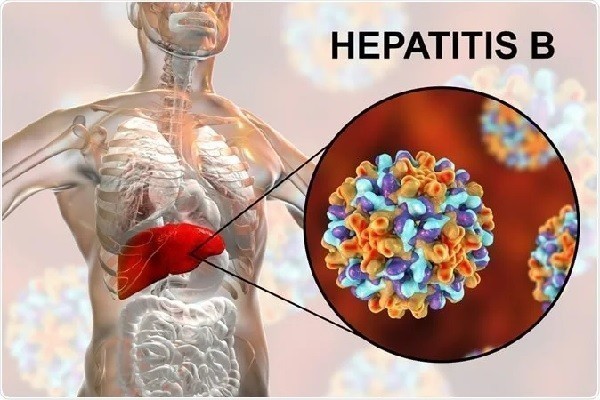 World Hepatitis Day: Over 18m Nigerians Infected with Hepatitis – Minister