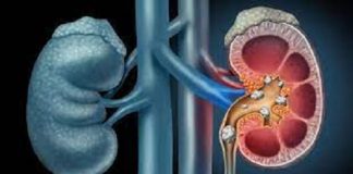 World Kidney Day: Towards a National Policy on Kidney Care