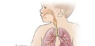 FG Declares State of Emergency on Childhood TB
