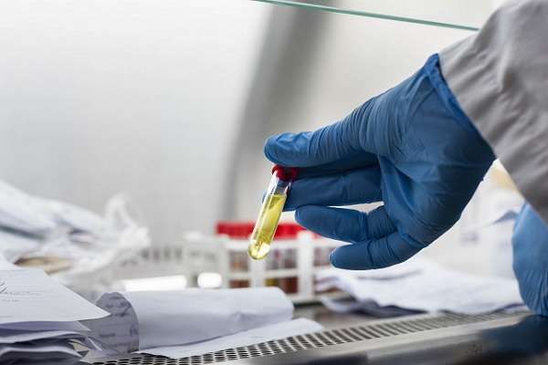 U.S. CDC Partners NCDC to Establish Rapid Testing Laboratories